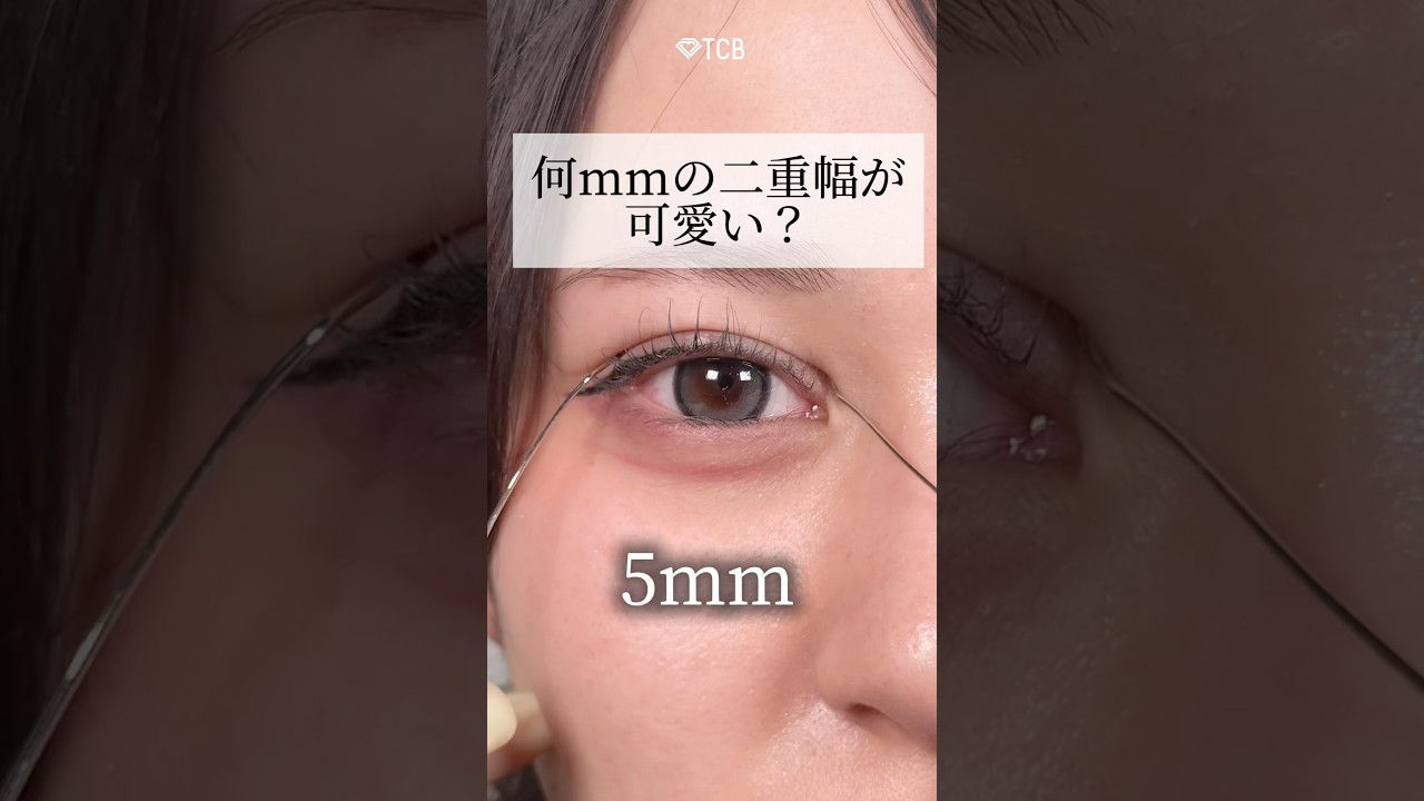 二重整形】何mmの二重幅が可愛い？ #shorts - YouTube
