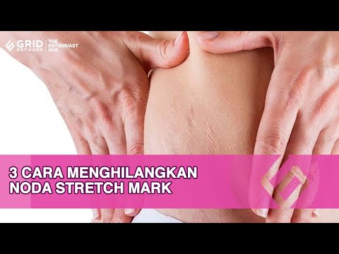Video: 3 Cara Menghilangkan Stretch Mark