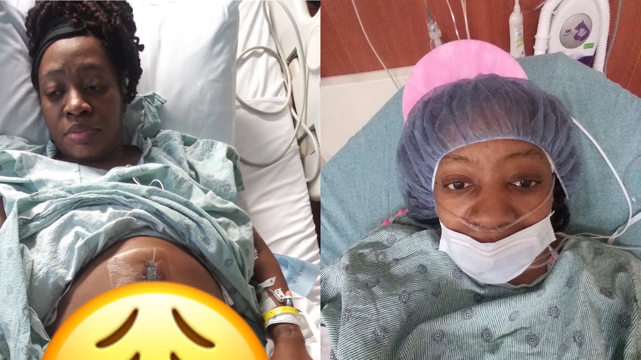 MY DR. FOUND STOOL IN MY ABDOMEN DURING SURGERY! YouTube