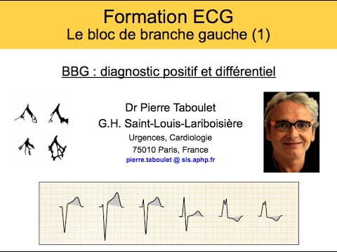 Vidéo: Bloc Cardiaque Ou Retard De Conduction (antérieur Gauche) Chez Les Chiens