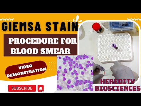 Giemsa Stain Procedure For Blood Smear Hereditybioacademy7062