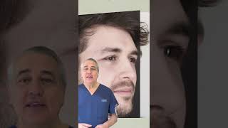 ✨ Resultado de la rinoplastia ultrasónica realizada a Dalas. ✨ Resultado de la rinoplastia ultrasónica realizada a Dalas.