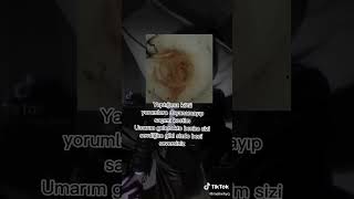 Katlanamiyorum...ş Şum