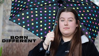 Im Allergic To Water - And People Ask Me If I Shower Born Different