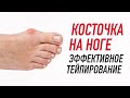 Тейпирование при "косточке" на стопе Hallus Valgus. Валентин Гайт. Учебный центр BBALANCE