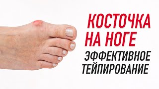 картинка: ✅ КОСТОЧКА НА НОГЕ. ЭФФЕКТИВНОЕ ТЕЙПИРОВАНИЕ | Валентин Гайт | Учебный центр BBALANCE