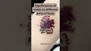 Find out what this mole on Right Palm Means screenshot 5