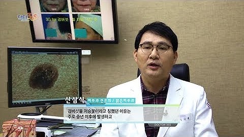 검버섯의 오해와 진실 [뷰티스맑은피부과][KBC 닥터365]