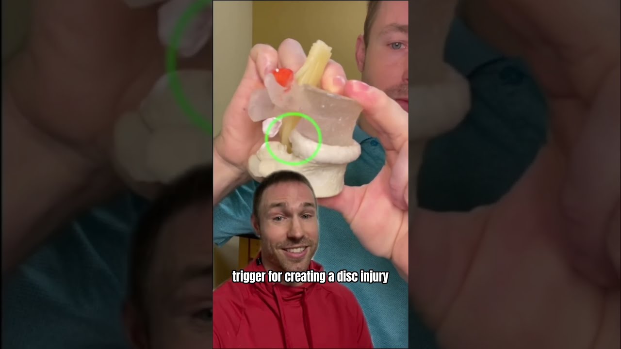 How To Fix A Disc Bulge WITHOUT SURGERY 