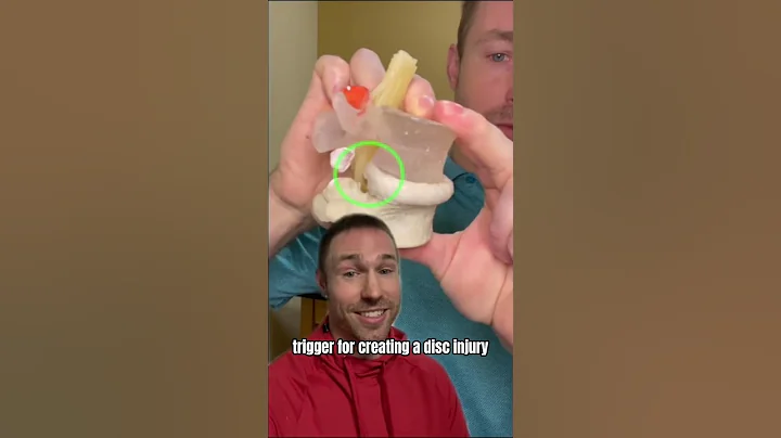 How to Fix a Disc Bulge (WITHOUT SURGERY) - DayDayNews