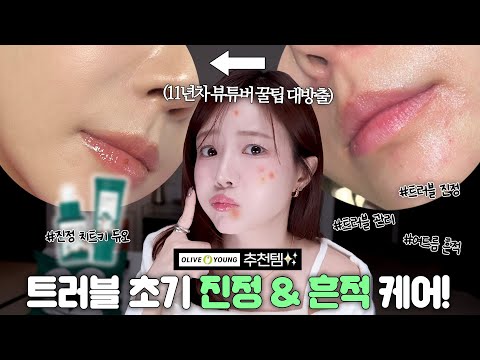 올리브영 추천템✨ 트러블 초기 진정 &amp;amp; 흔적 케어! 11년차 뷰튜버 꿀팁 대방출