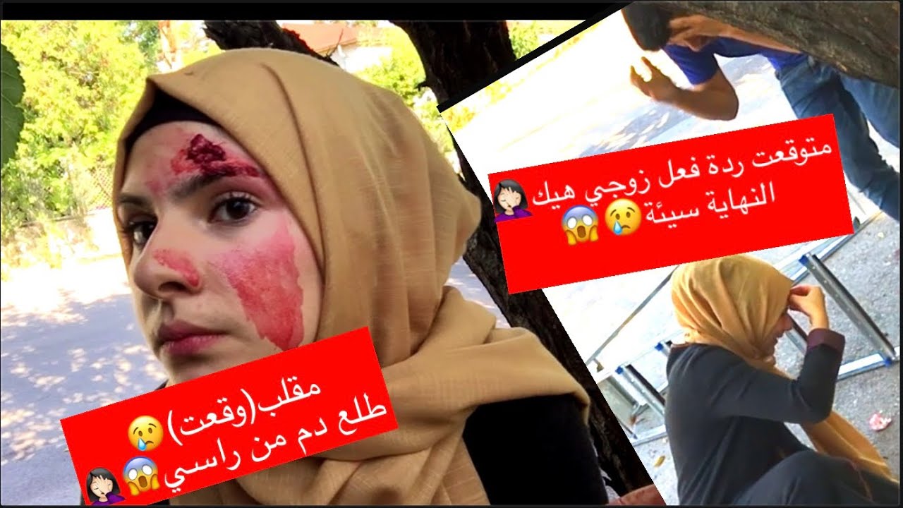 وقعت من الدرج على راسي 😱 || ردة فعل زوجي صدمتني😭💔|| مقلب🤫