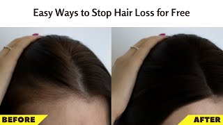 How To Prevent Hair Loss | How To Stop Hair Fall For Women At Home