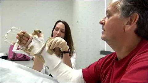 Hand Transplant Patient Ronald Thurman Hand Therap...