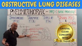Obstructive Lung Diseases | COPD, Chronic Bronchitis, Asthma, Bronchiectasis & Emphysema