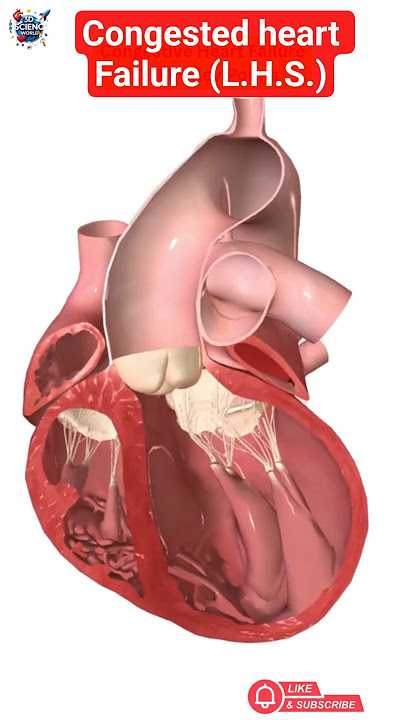 Why Your Heart Can Fail Without A Heart Attack