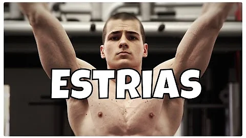 Quem tem estrias pode fazer academia?