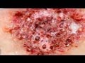 FX Makeup Series Acid Burns