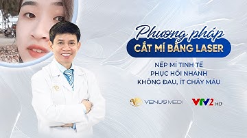[VTV2] Cắt mí mắt bằng Laser CO2 và những ưu điểm vượt trội