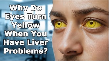 Why Do Eyes Turn Yellow When You Have Liver Problems?