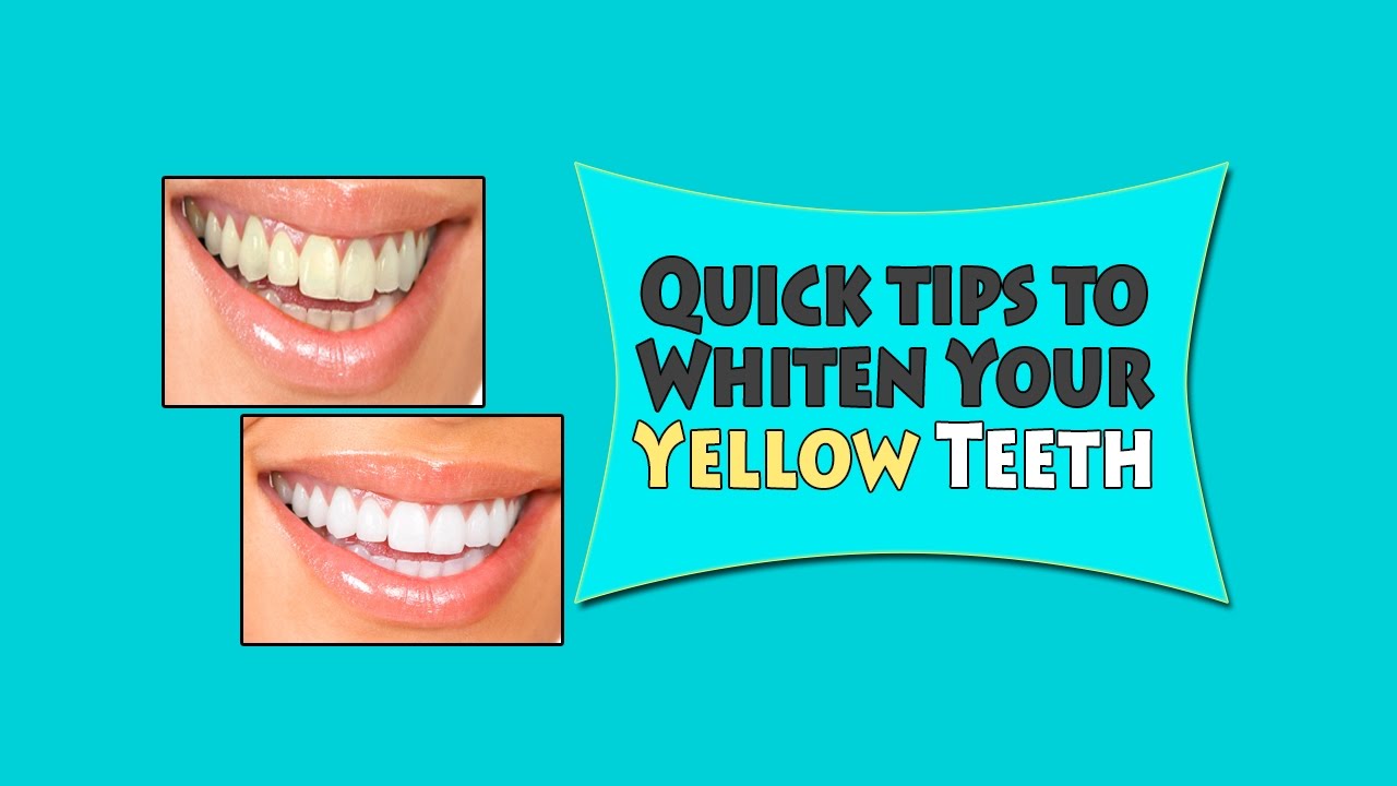 BEST QUICK TIPS TO WHITEN YOUR YELLOW TEETH YouTube