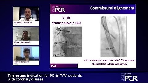 Timing and indication for PCI in TAVI patients with coronary disease