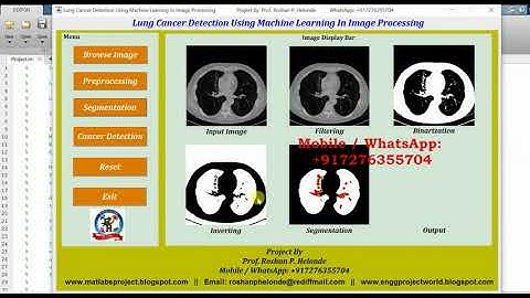 Matlab Code for Lung Cancer Detection Using Machine Learning Full Project Source Code | IEEE Project
