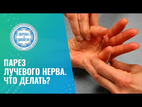 🤏 Парез лучевого нерва. Что делать?