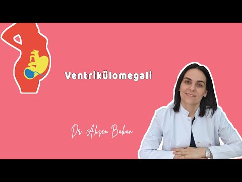 Video: Genişleme boşluğunu nasıl hesaplarsınız?