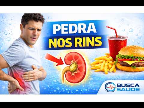 Alimentos que causam pedras nos Rins - Prevenir pedras no RIM.