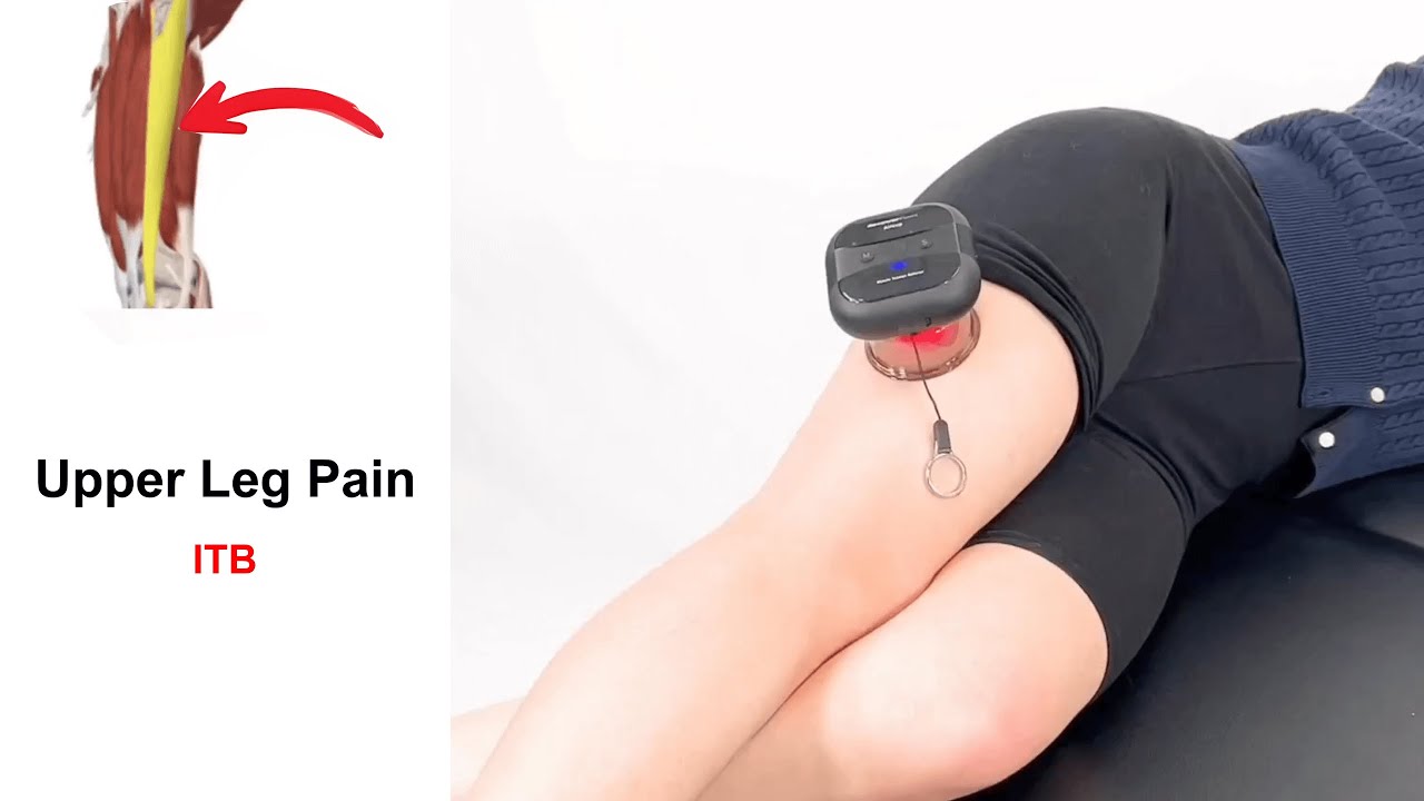 Upper Leg Pain Release Cupping Massage for ITB YouTube