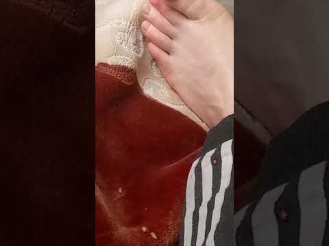 رجلي مجروحه في امل اعيش