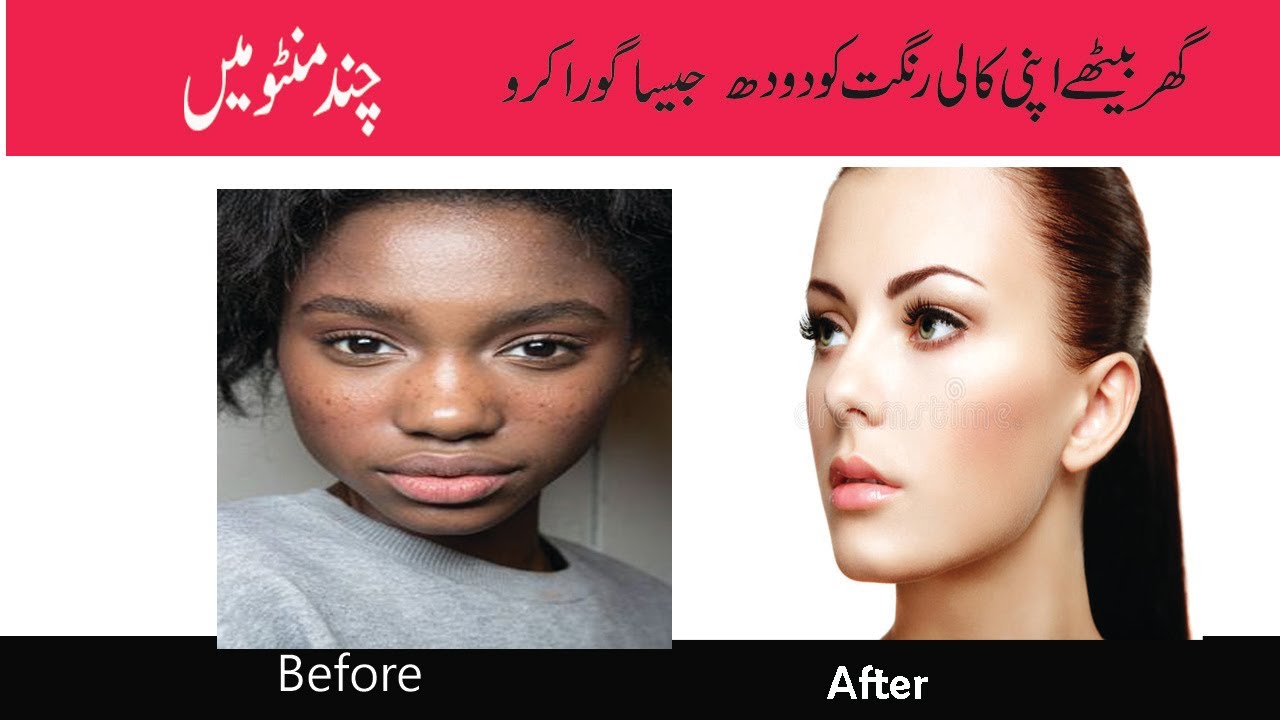 home remedies for pitta on skin in hindi