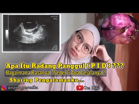 Sharing Diagnosa Radang Panggul ( PID ) || Cairan Bebas || Hidrosalping || Pseudokista || Free Fluid