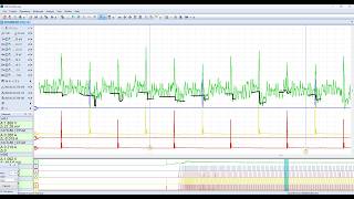 24 Aplicacion de filtro a señales con USB Auto scope