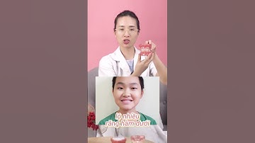 NIỀNG RĂNG MÓM #bshong #bshongniengrang #niengrang