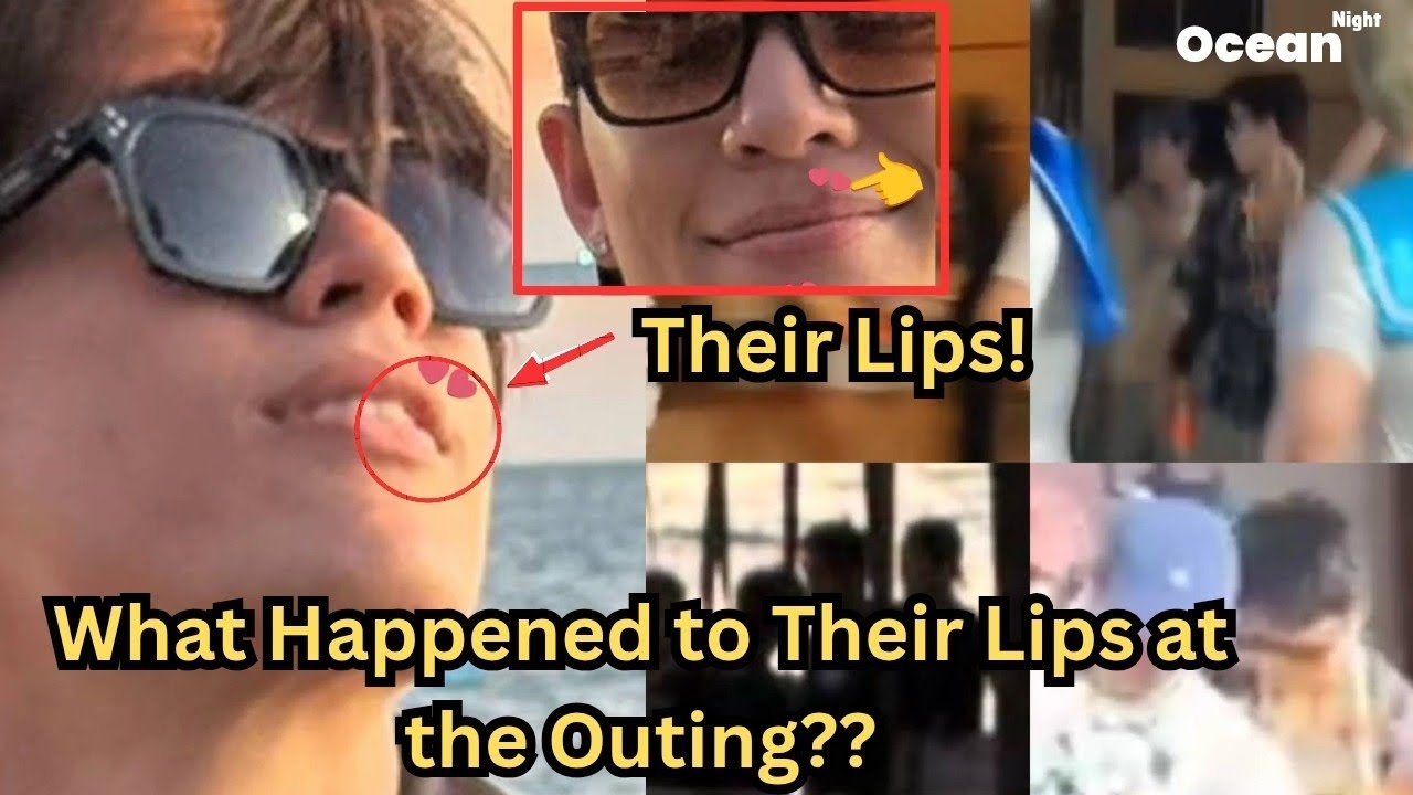 What Happened to JossGawin `s Lips at the Outing?? ||  #jossgawin 