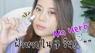 Am Herb Anti-Melasma Serum ฝ้าหายใน 7 วันจริงป่ะเนี่ย!