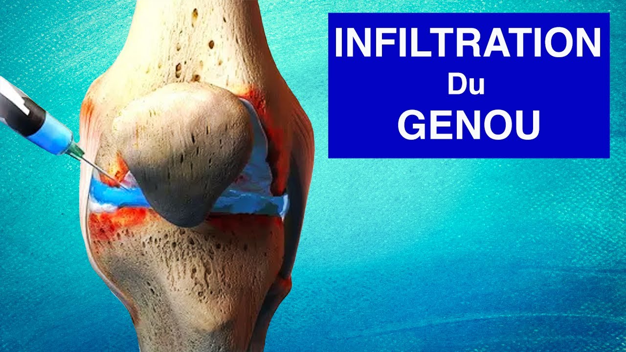 Stabilisateur de genou avec gel - Samson