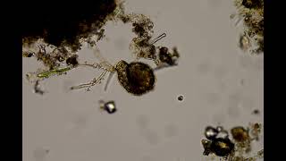 Difflugia testate amoebae under a microscope