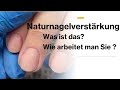 NATURNAGELVERSTÄRKUNG // Was ist das eigentlich? Wie arbeitet man sie?