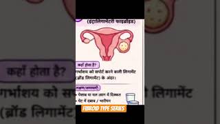fibroid type series # fibroid