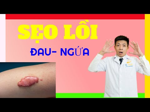 Video: Làm thế nào để ngăn sẹo lồi phát triển: 10 bước (có hình ảnh)