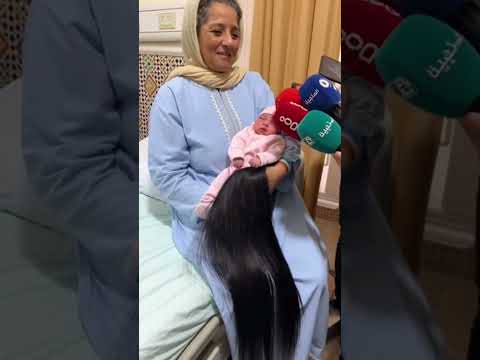 إمرأ تزادت عندها طفلة عندها شعر من رأسها حتى رجليها