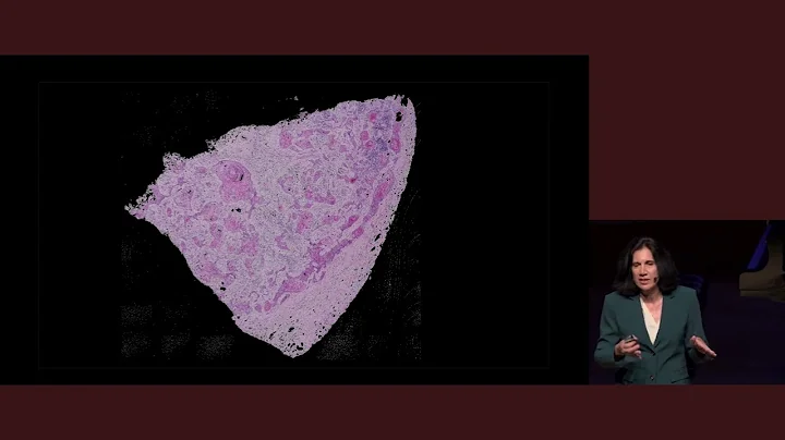 Frontiers in Medicine 2024 | AI in Oncology: Predicting Cancer’s Course