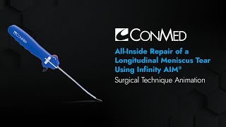 All-Inside Repair Of A Longitudinal Meniscus Tear Using Infinity Aim - Conmed Animation