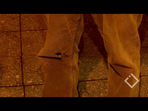 ბათუმში ძაღლებმა მოქალაქე დაკბინეს