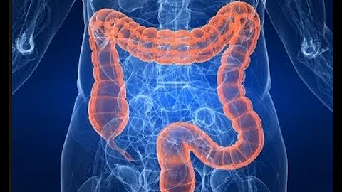 Colon Hydrotherapy, from the street, to my door......