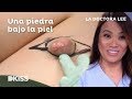 La doctora Lee y una piedra bajo la piel | La doctora Lee