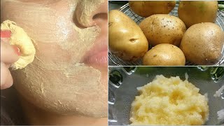 Patato Facial Mask It Removes Dark spot || Madoneysa Waji Dhalaalayo Intaas Ila Tijaabi||